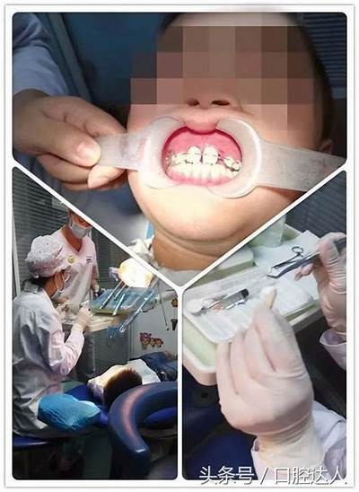 王森先生的牙齿健康与护理经验分享