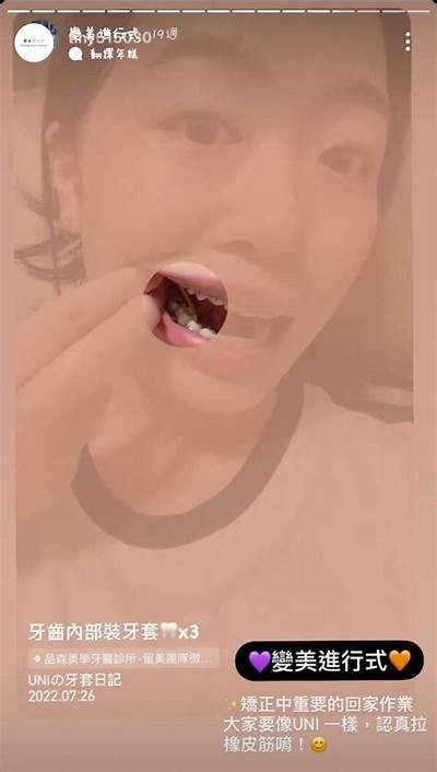 三森先生的好色口腔：健康与欲望的较量